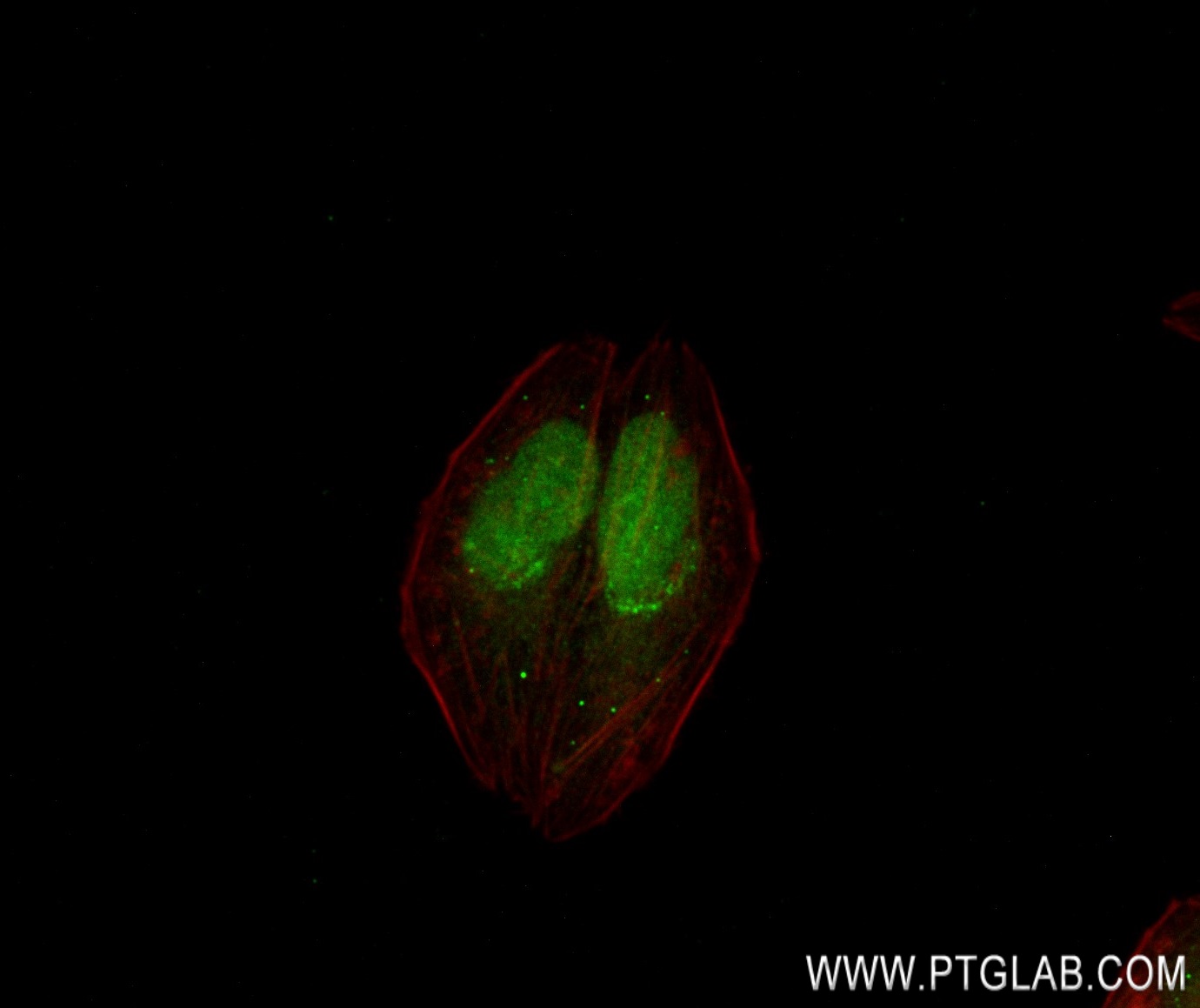 Immunofluorescence (IF) / fluorescent staining of HepG2 cells using p300 Recombinant antibody (83078-5-RR)