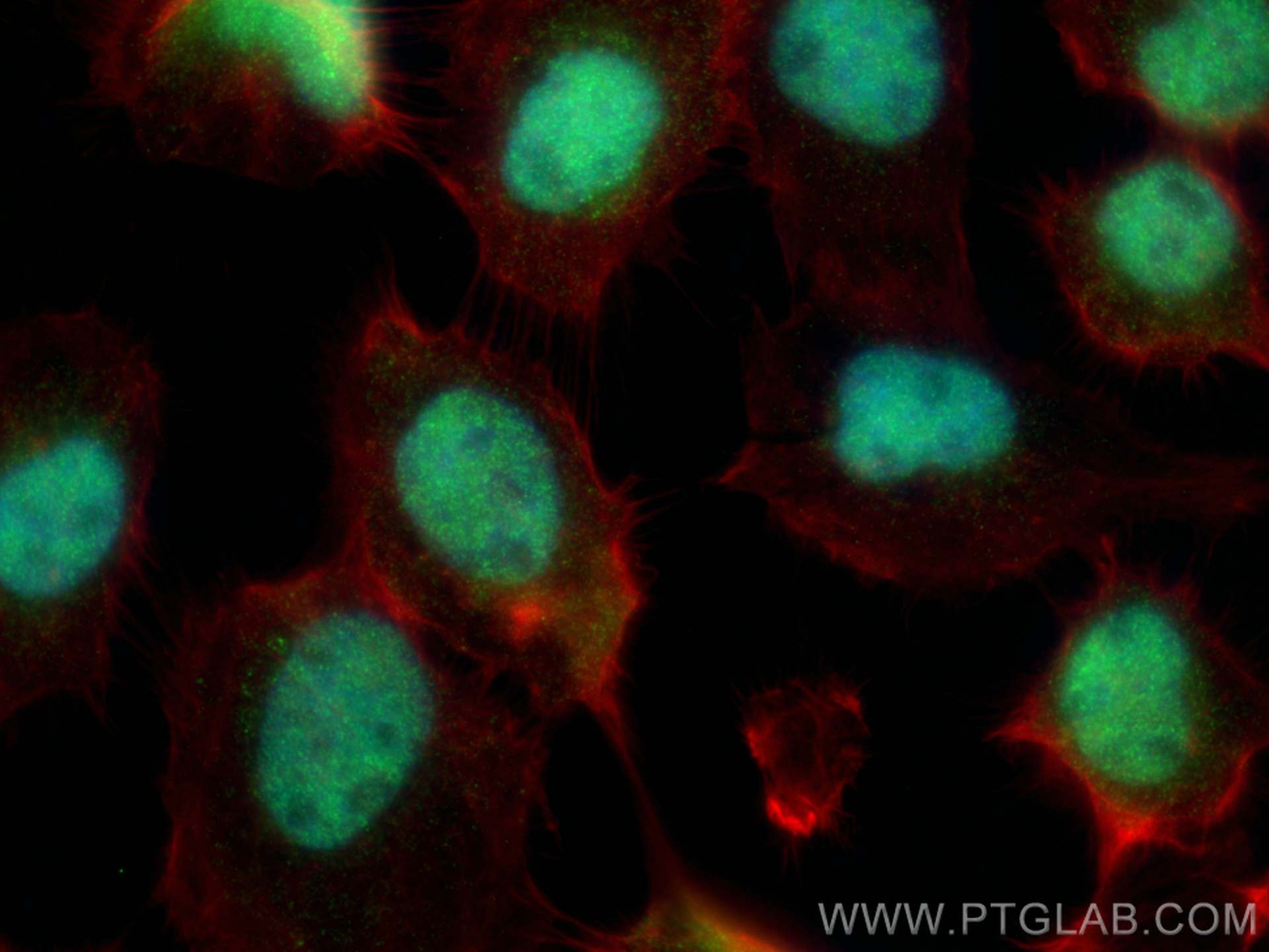 Immunofluorescence (IF) / fluorescent staining of A431 cells using p300 Recombinant antibody (83078-5-RR)