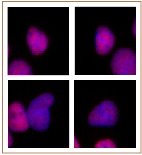 p300 antibody (mAb) tested by immunofluorescence. Formaldehyde fixed HeLa cells stained with p300 antibody at a 0.5 ug/ml dilution.