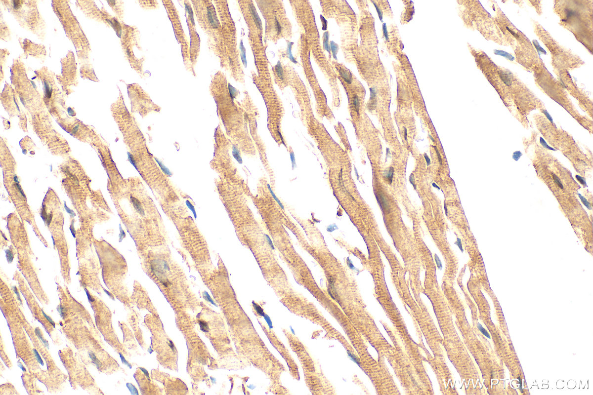 Immunohistochemistry (IHC) staining of mouse heart tissue using p38 MAPK Polyclonal antibody (14064-1-AP)