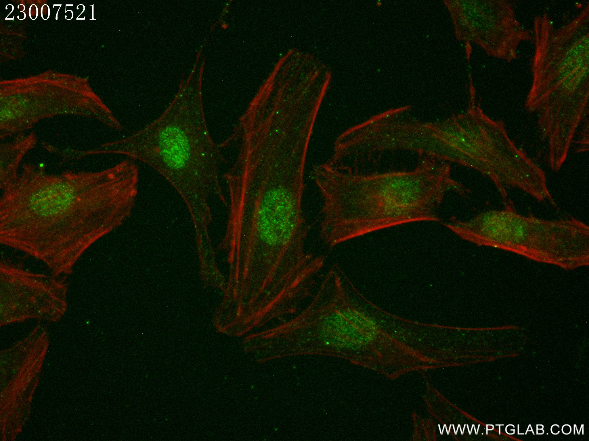 Immunofluorescence (IF) / fluorescent staining of HeLa cells using p38 MAPK Recombinant antibody (80821-2-RR)