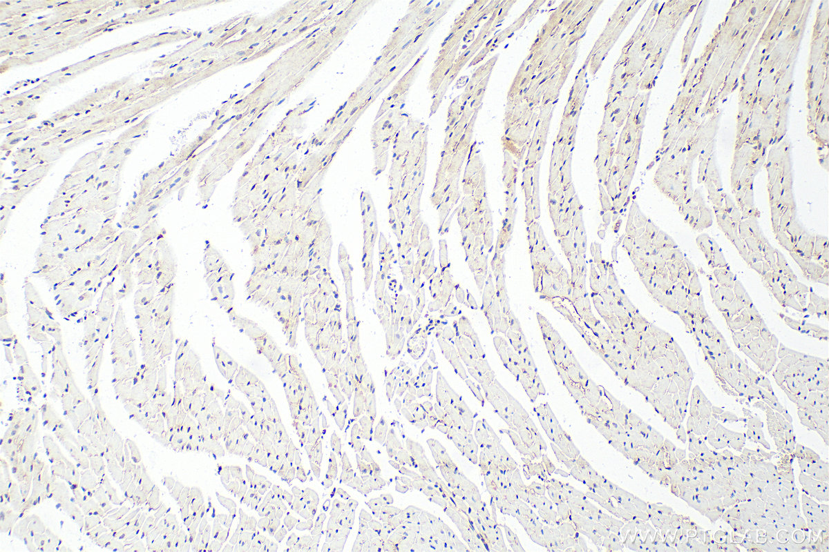 Immunohistochemistry (IHC) staining of mouse heart tissue using Multi-rAb™ p38 MAPK Multi-Recombinant antibody (RMX00006)