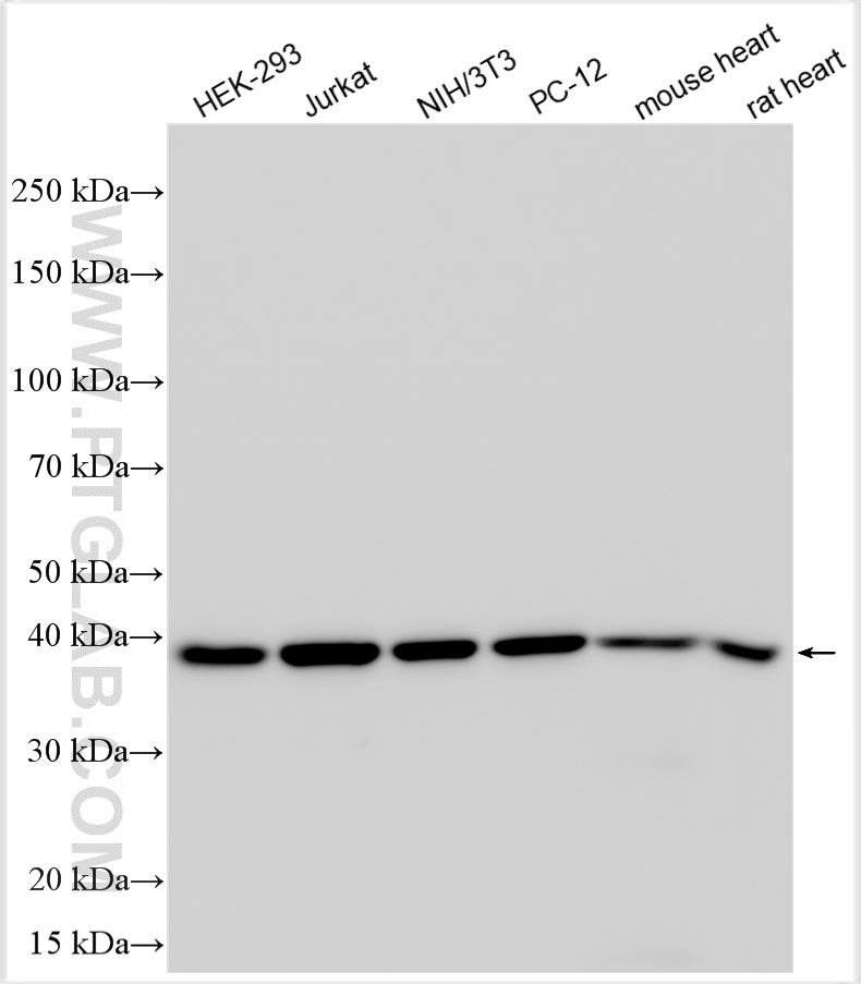 Western Blot (WB) analysis of various lysates using Multi-rAb™ p38 MAPK Multi-Recombinant antibody (RMX00006)