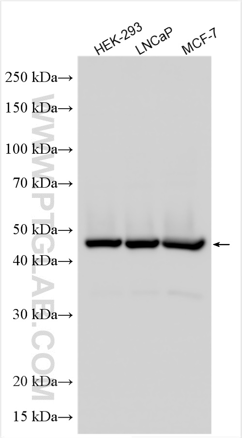 Western Blot (WB) analysis of various lysates using AMACR/p504S Polyclonal antibody (15918-1-AP)