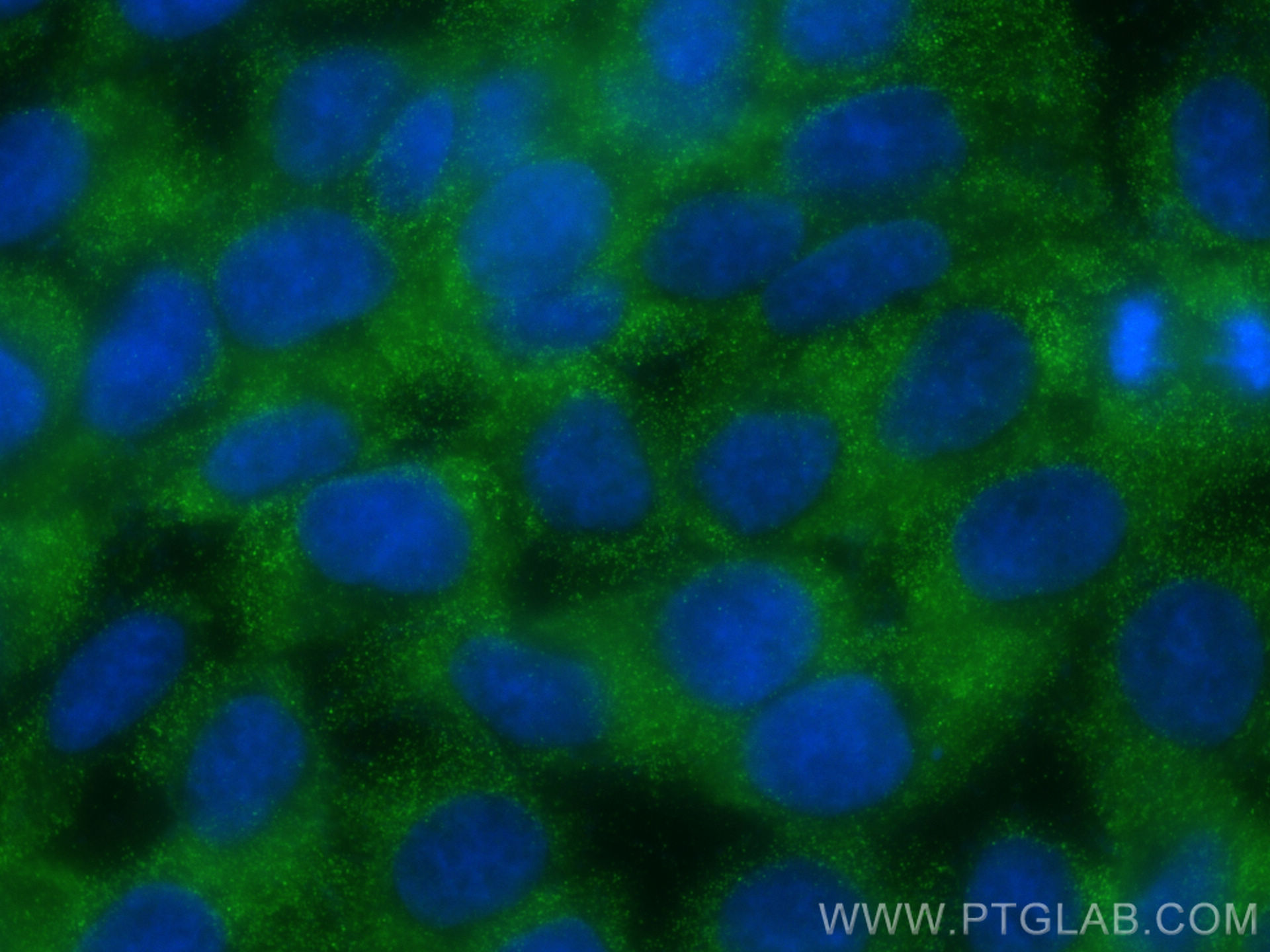 Immunofluorescence (IF) / fluorescent staining of A431 cells using p504S,AMACR Monoclonal antibody (60240-1-Ig)