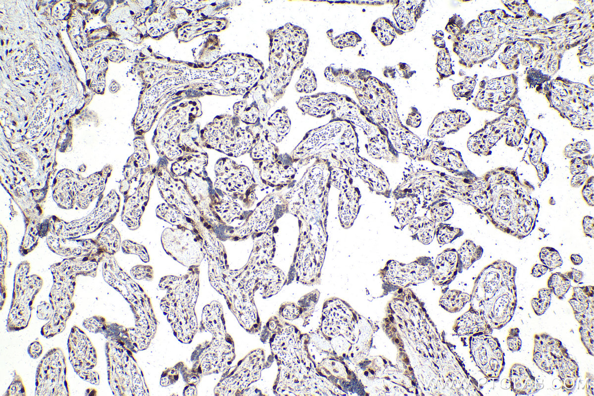 Immunohistochemistry (IHC) staining of human placenta tissue using p57Kip2 Monoclonal antibody (66794-1-Ig)