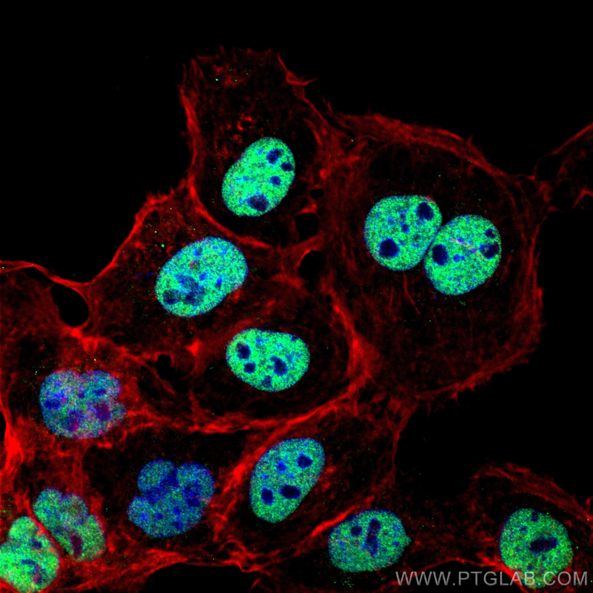 Immunofluorescence (IF) / fluorescent staining of A431 cells using CoraLite® Plus 488-conjugated p63 Polyclonal antib (CL488-12143)