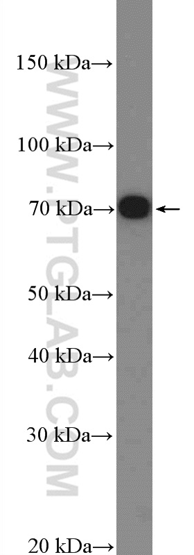 Western Blot (WB) analysis of HeLa cells using NF-κB p65 Polyclonal antibody (10745-1-AP)