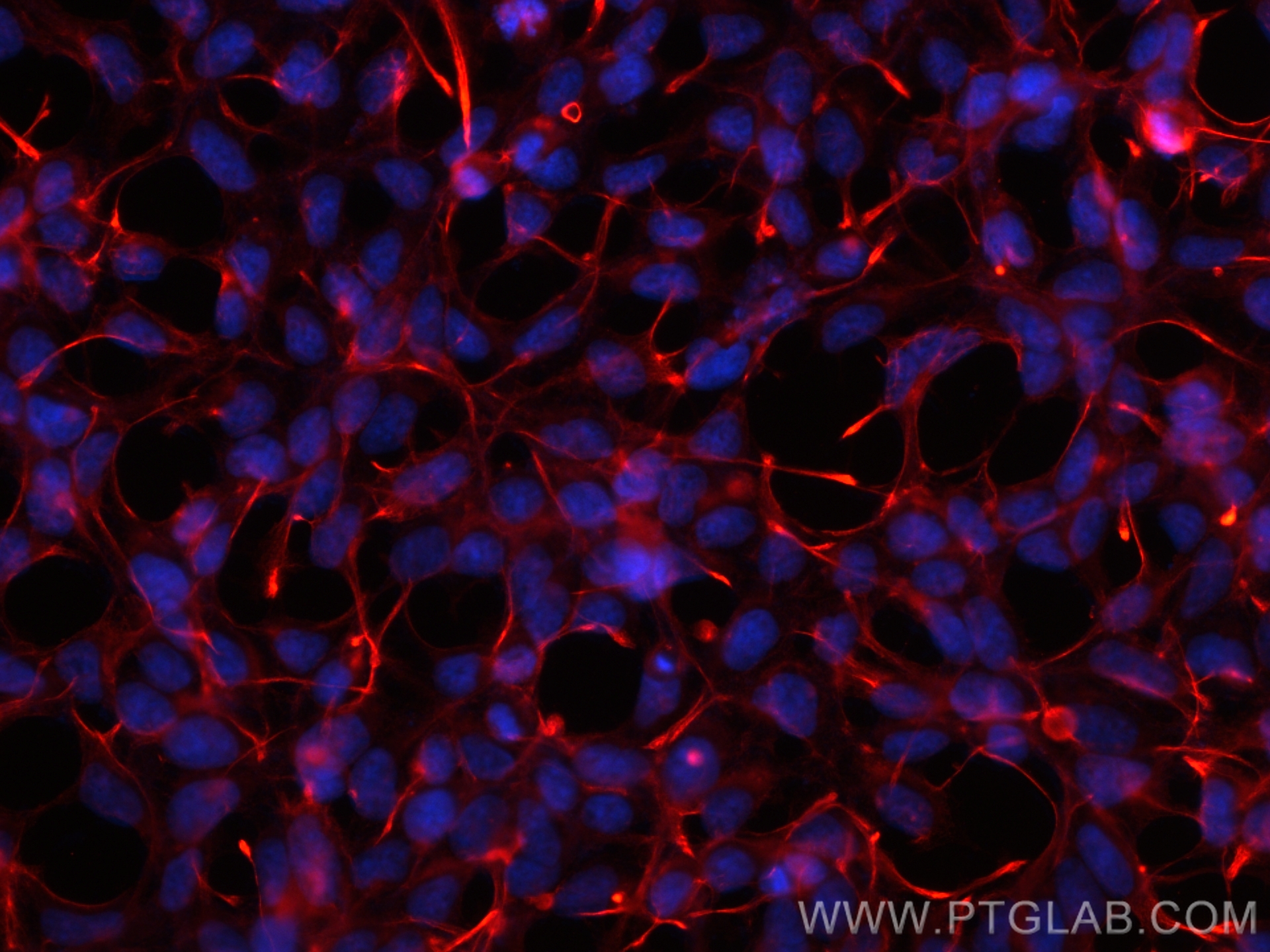 Immunofluorescence (IF) / fluorescent staining of HEK-293 cells using CoraLite®594-conjugated pan Ras Monoclonal antibod (CL594-60309)