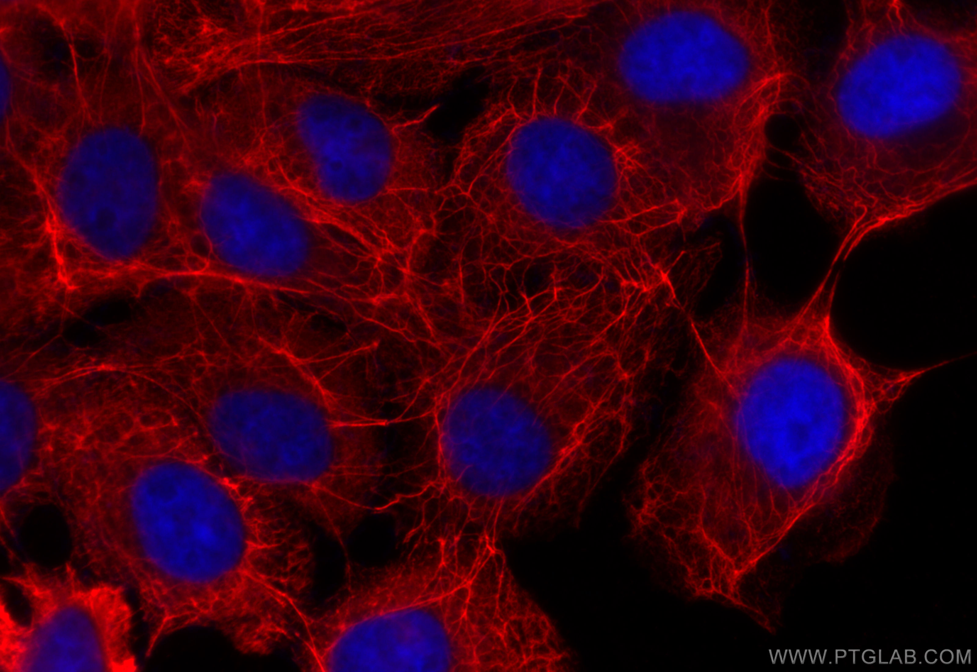 Immunofluorescence (IF) / fluorescent staining of A431 cells using pan-keratin Polyclonal antibody (26411-1-AP)