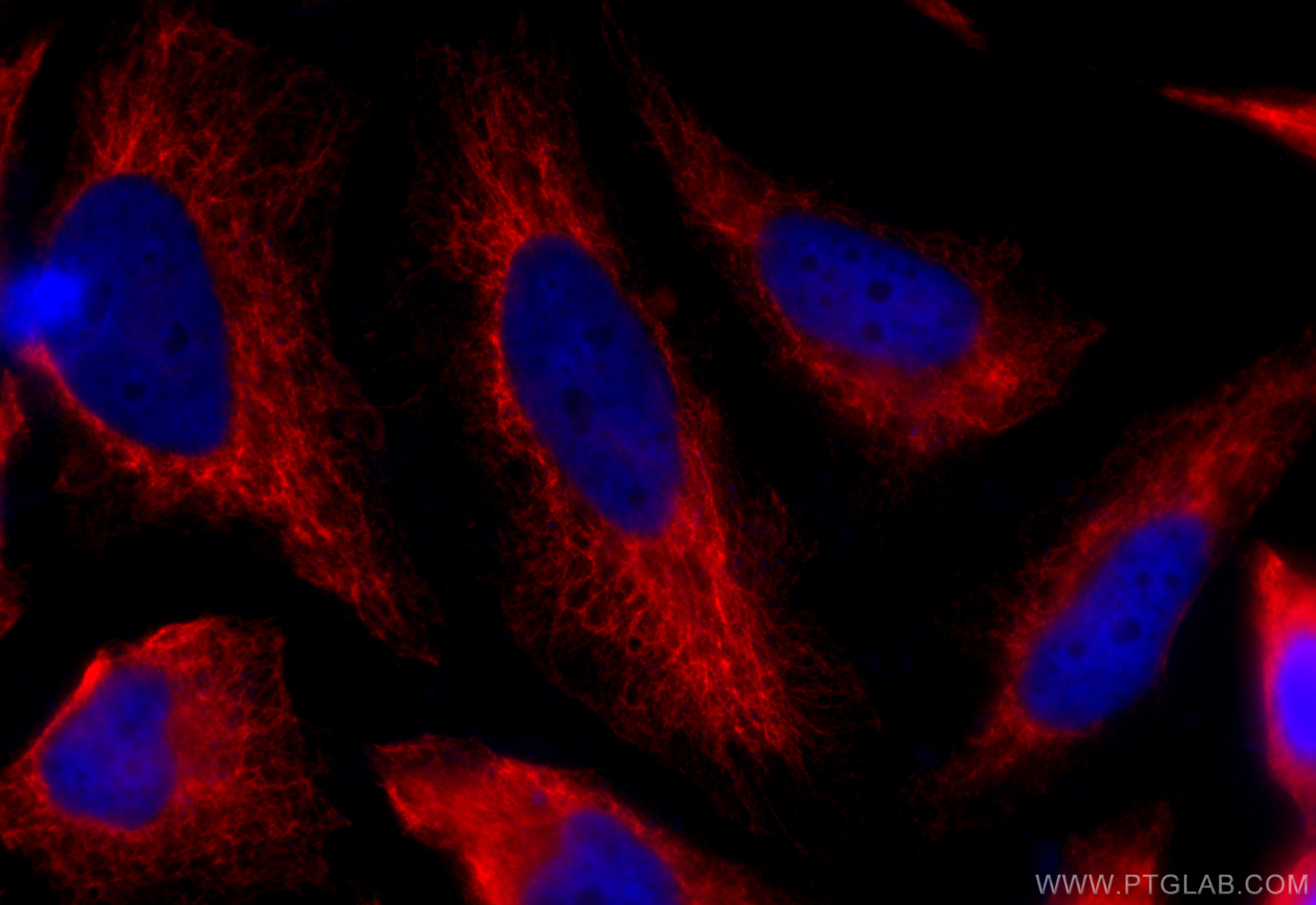 Immunofluorescence (IF) / fluorescent staining of HeLa cells using pan-keratin Polyclonal antibody (26411-1-AP)