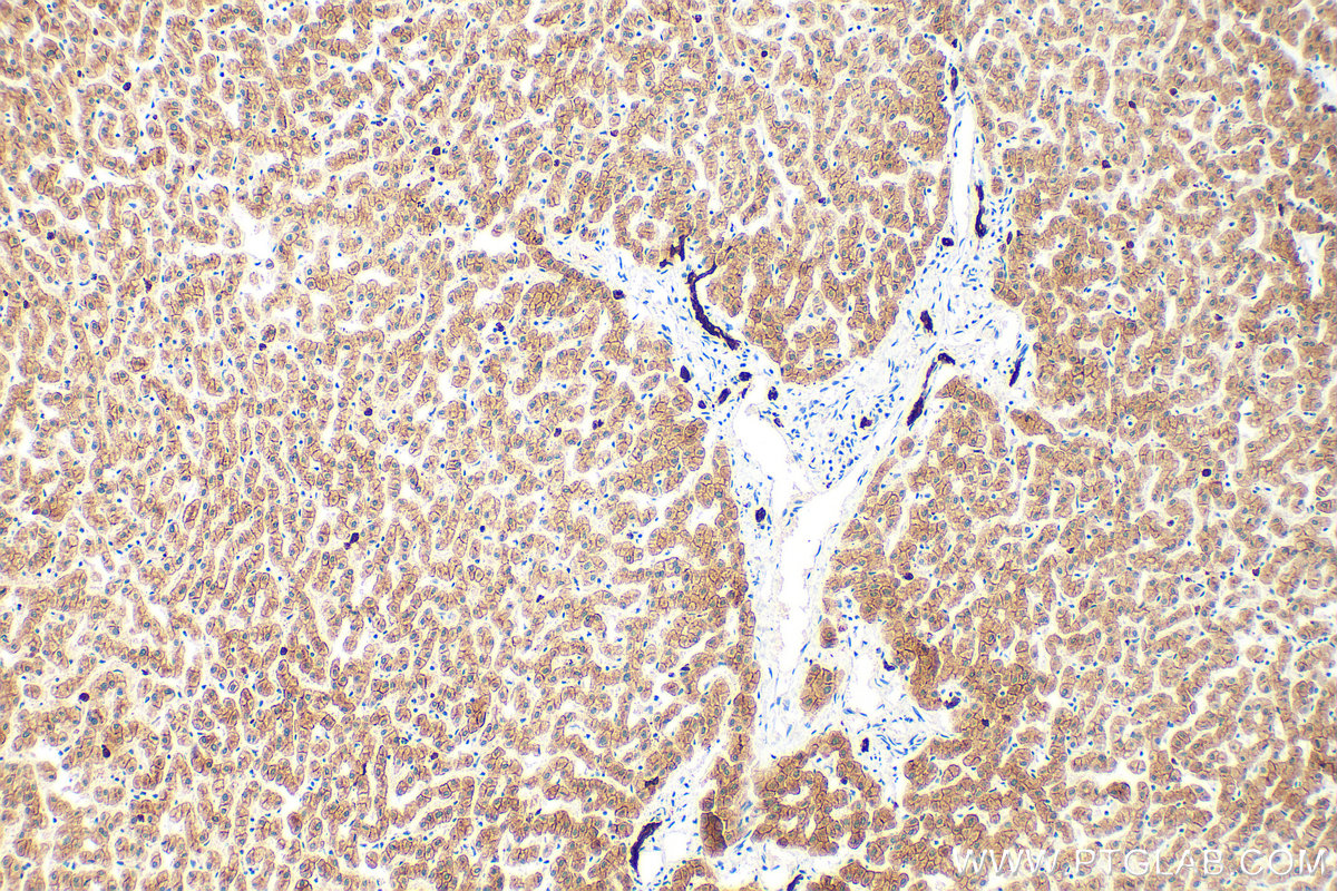 Immunohistochemistry (IHC) staining of human liver tissue using Pan-Keratin Polyclonal antibody (26411-1-AP)