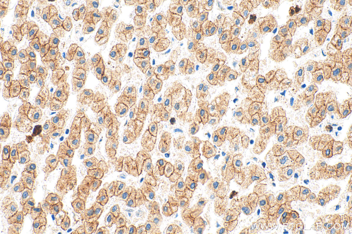 Immunohistochemistry (IHC) staining of human liver tissue using Pan-Keratin Polyclonal antibody (26411-1-AP)