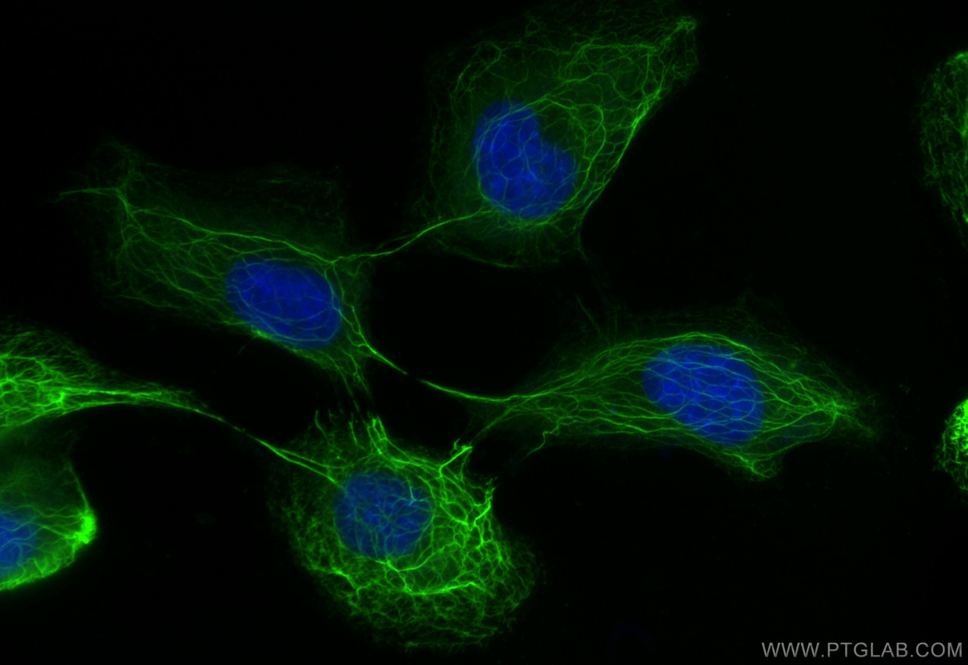 Immunofluorescence (IF) / fluorescent staining of A431 cells using CoraLite® Plus 488-conjugated pan-keratin Polyclon (CL488-26411)