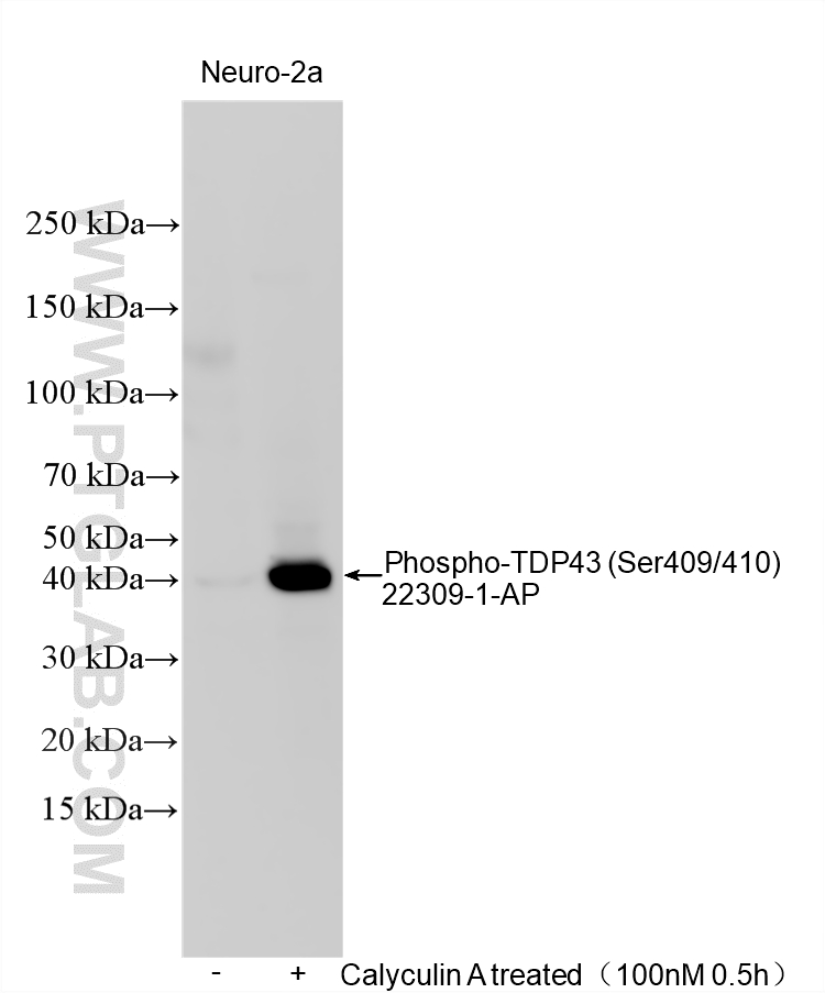 Western Blot (WB) analysis of various lysates using Phospho-TDP43 (Ser409/410) Polyclonal antibody (22309-1-AP)
