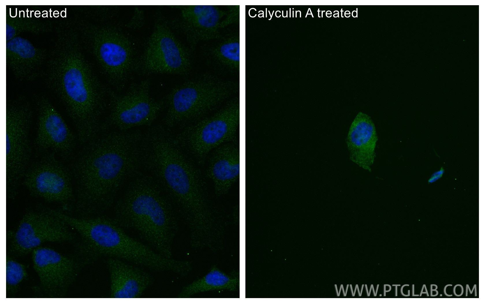 Immunofluorescence (IF) / fluorescent staining of HeLa cells using Phospho-TDP43 (Ser409/410) Recombinant monoclonal (80007-1-RR)