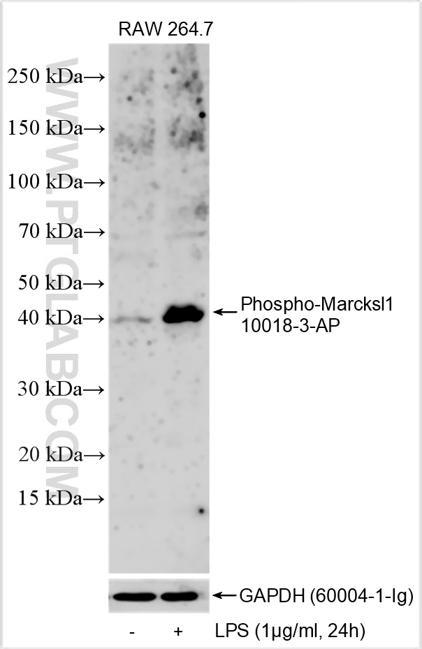 Western Blot (WB) analysis of various lysates using Phospho-Marcksl1 Polyclonal antibody (10018-3-AP)