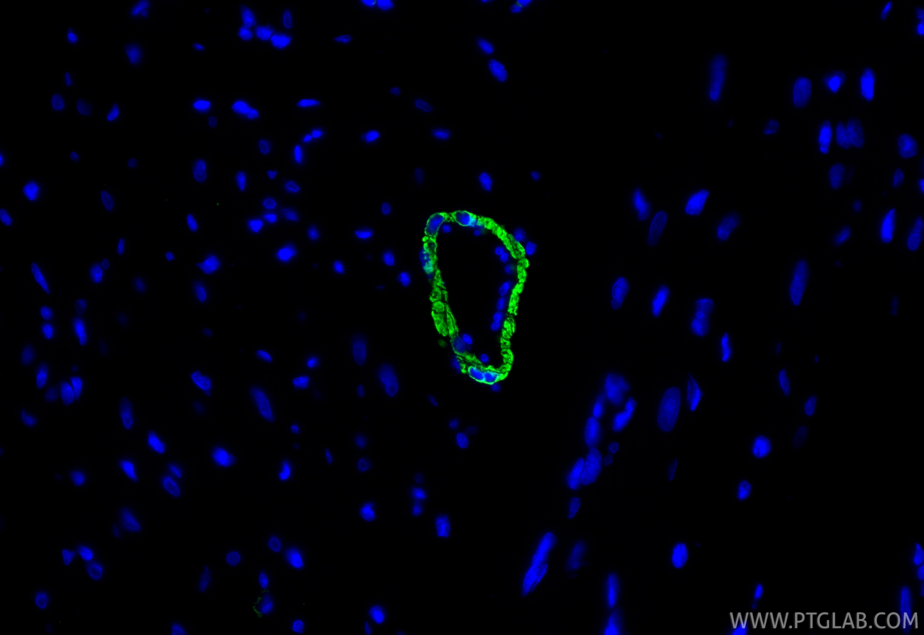 Immunofluorescence (IF) / fluorescent staining of rat heart tissue using Alpha smooth muscle actin specific Monoclonal anti (67735-1-Ig)