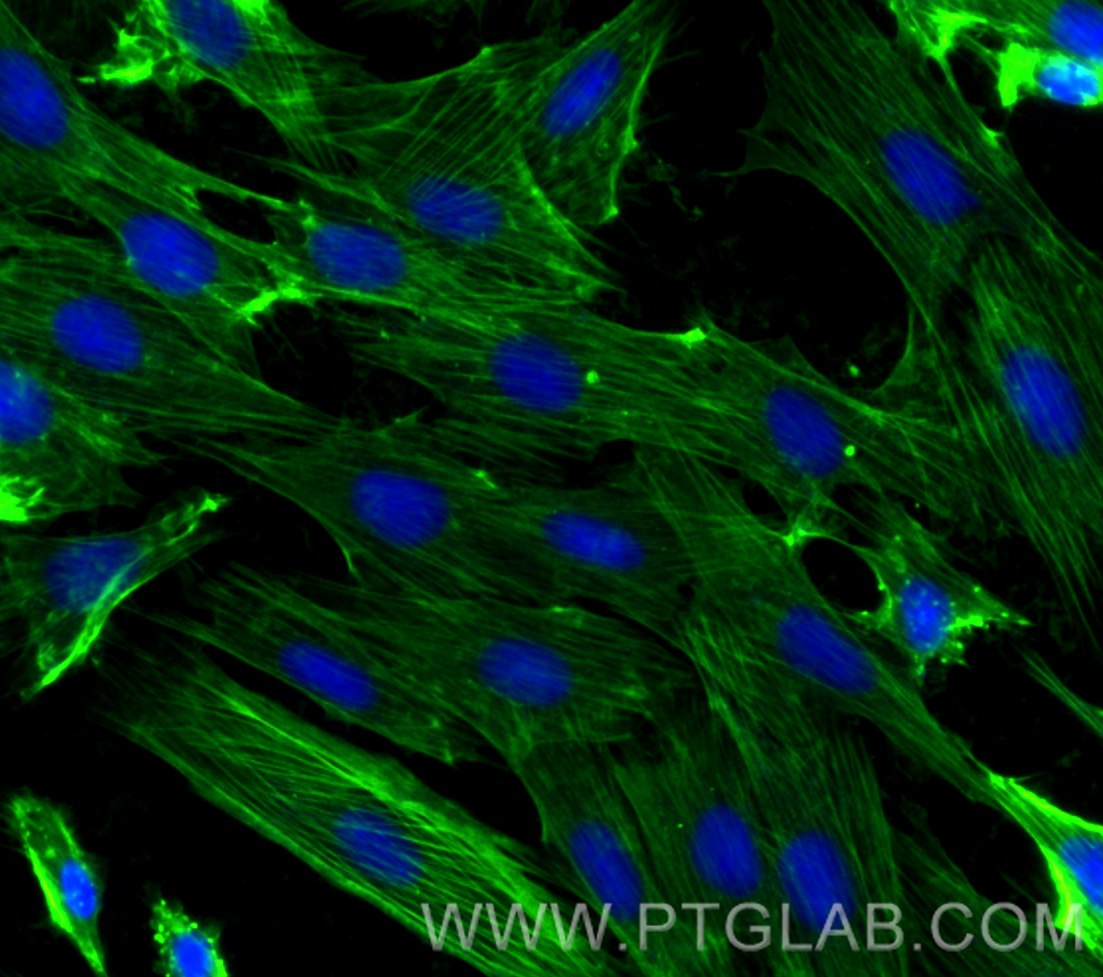 Immunofluorescence (IF) / fluorescent staining of H9C2 cells using CoraLite® Plus 488-conjugated smooth muscle actin  (CL488-80008)