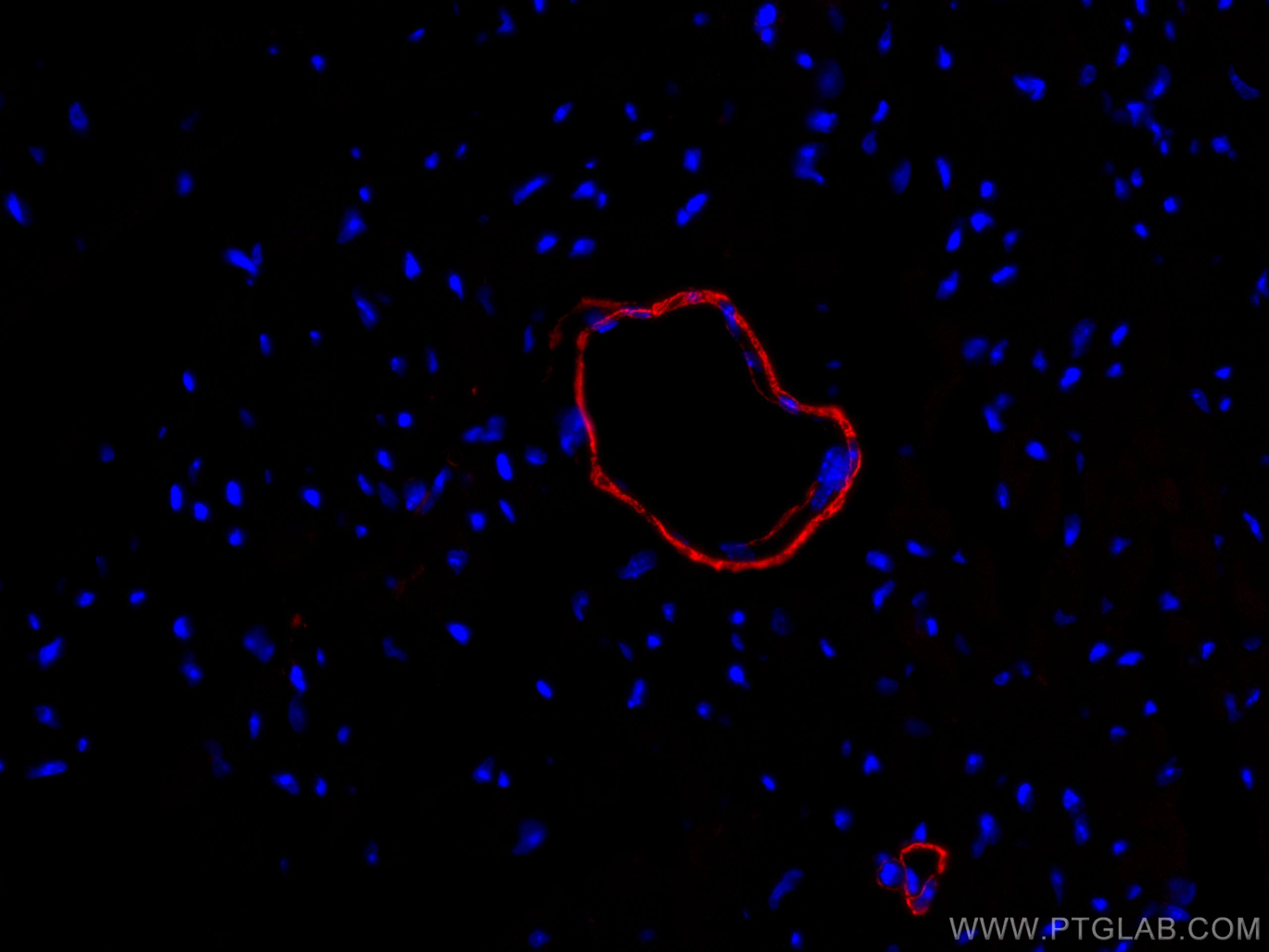 Immunofluorescence (IF) / fluorescent staining of mouse heart tissue using CoraLite®594-conjugated smooth muscle actin specif (CL594-55135)
