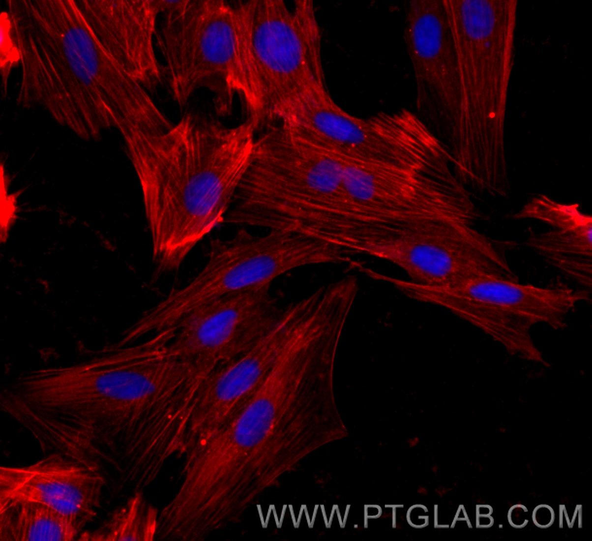 Immunofluorescence (IF) / fluorescent staining of H9C2 cells using CoraLite®594-conjugated smooth muscle actin specif (CL594-80008)