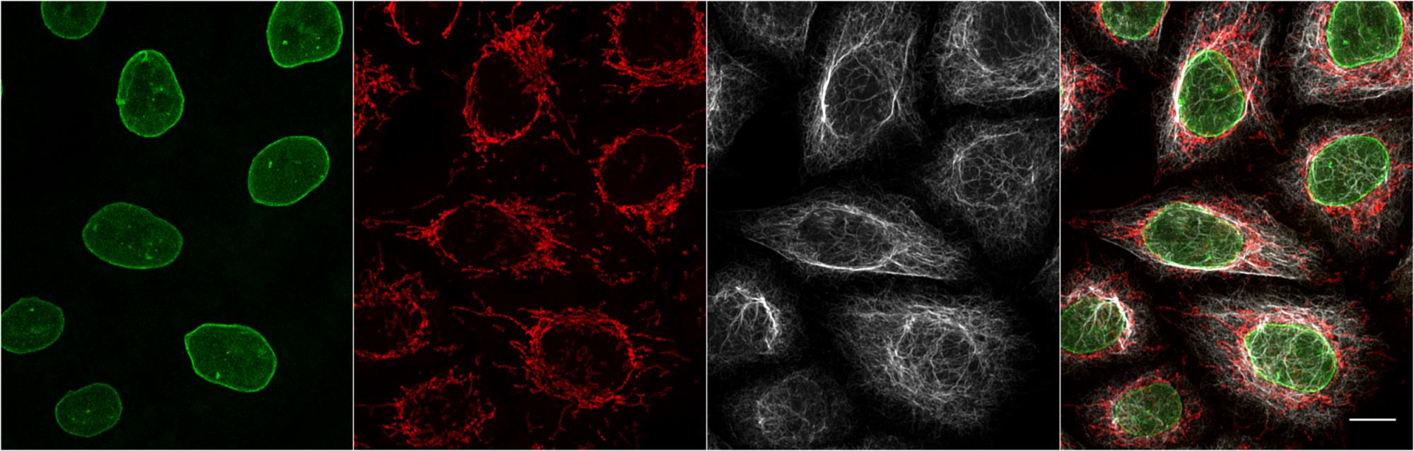 3種類のサブクラスが異なるマウス抗体と3種類の各サブクラス特異的Nano-Secondary®を使用したマルチプレックス免疫蛍光染色