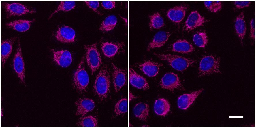 One-step staining (left) vs. sequential staining (right) of HeLa cells with anti-COX4 (mitochondria) mouse IgG1 monoclonal primary antibody + alpaca anti-mouse IgG1 VHH Alexa Fluor® 647 (magenta). Cell nuclei are stained with DAPI (blue). Scale bar, 20 μm.