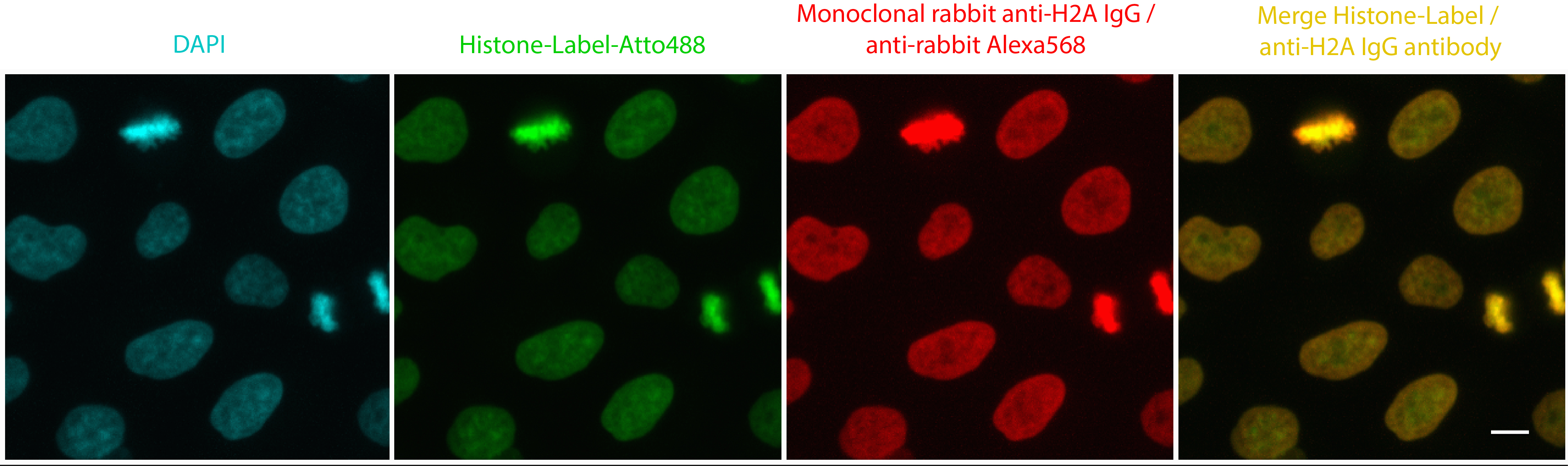 ChromoTek Histone-Label is a convenient, ready to use, and high-performing chromatin staining probe with low background levels and that differentiates between euchromatin and heterochromatin. HeLa cells stained in parallel with Histone-Label (1.25 mg/L) and a monoclonal rabbit anti-H2A IgG / anti-rabbit Alexa568 secondary antibody. Histone-Label co-localizes with conventional antibody staining, however Histone-Label better penetrates into the compactly packed nuclei than the anti-H2A IgG and secondary IgGs, which are one order of magnitude larger than the Histone-Label: see more green signal from Histone-Label at center of nuclei and more red signal from anti-H2A IgG on surface/edge of nuclei of merge image on very right.