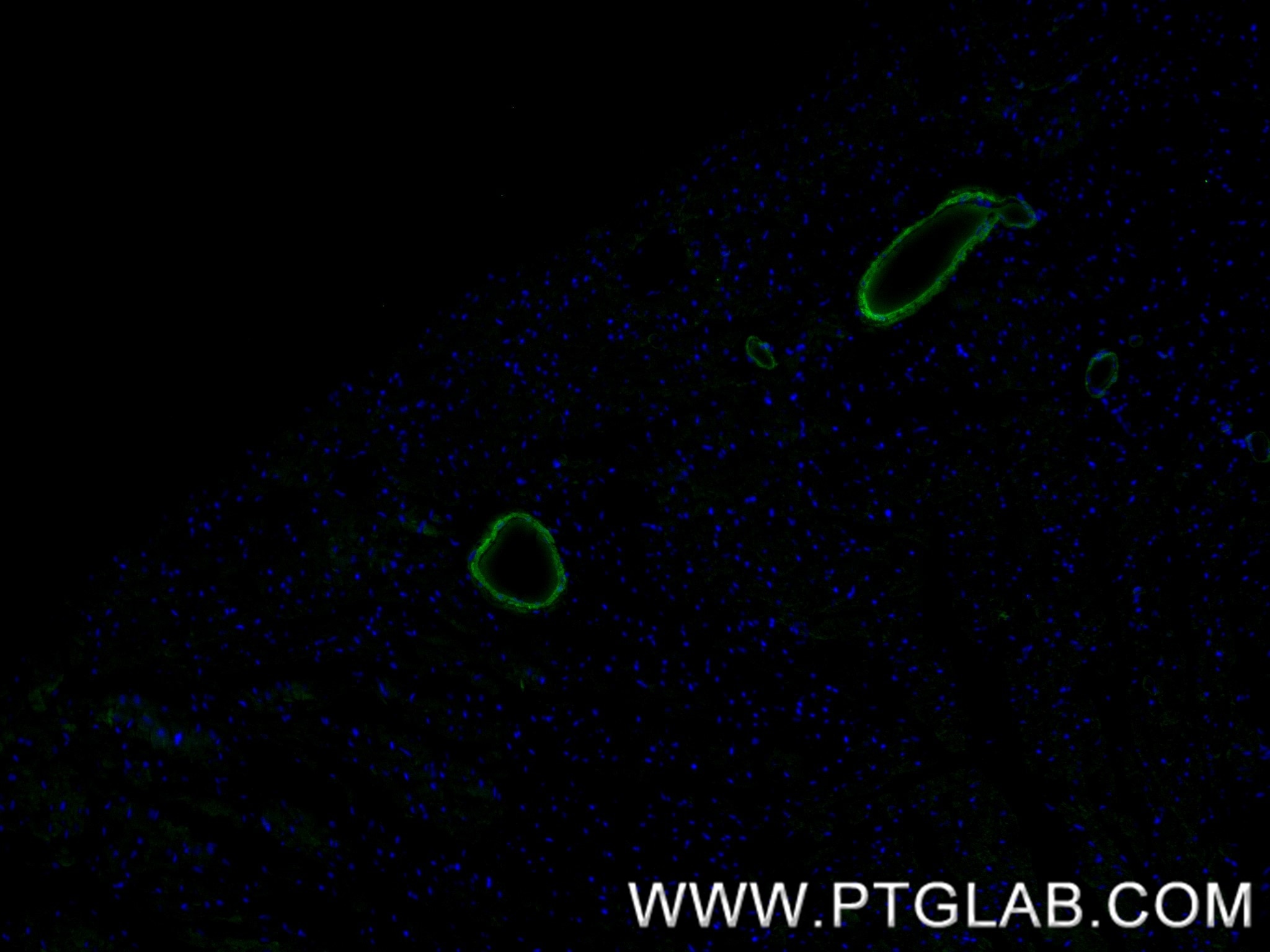 Immunofluorescence (IF) / fluorescent staining of mouse heart tissue using transgelin/SM22 Recombinant monoclonal antibody (83922-2-RR)