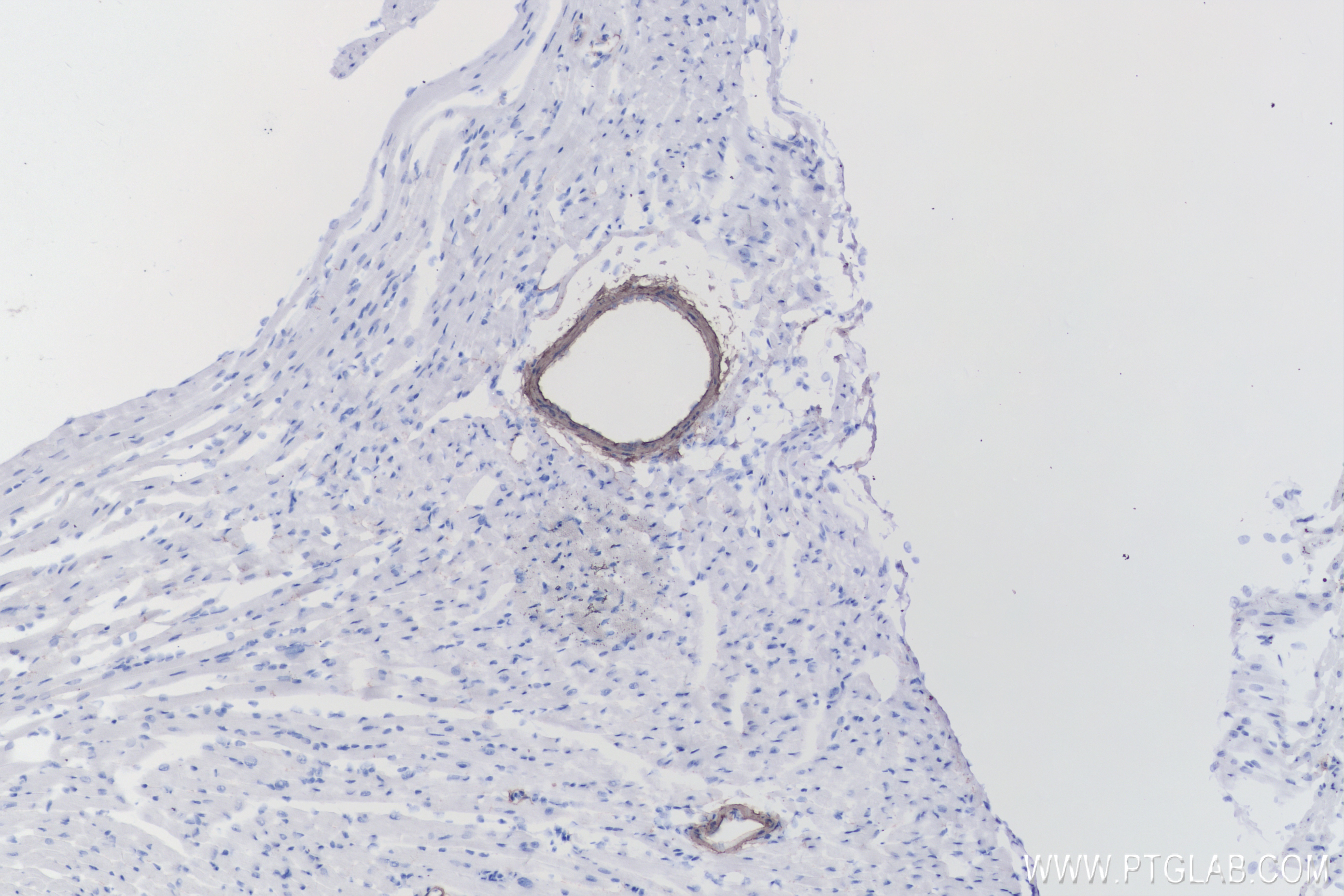 Immunohistochemistry (IHC) staining of mouse heart tissue using transgelin/SM22 Recombinant antibody (83922-2-RR)