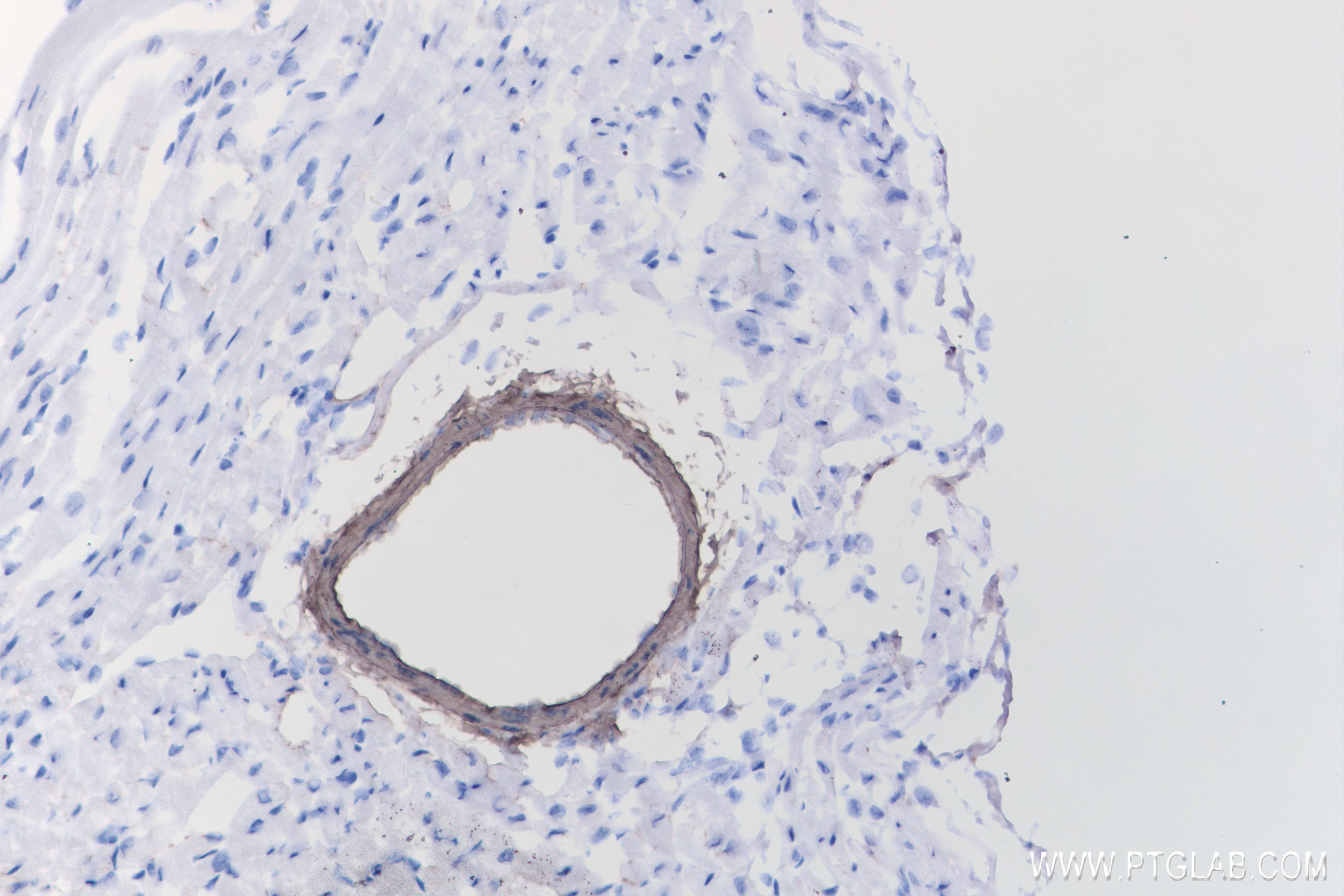 Immunohistochemistry (IHC) staining of mouse heart tissue using transgelin/SM22 Recombinant antibody (83922-2-RR)