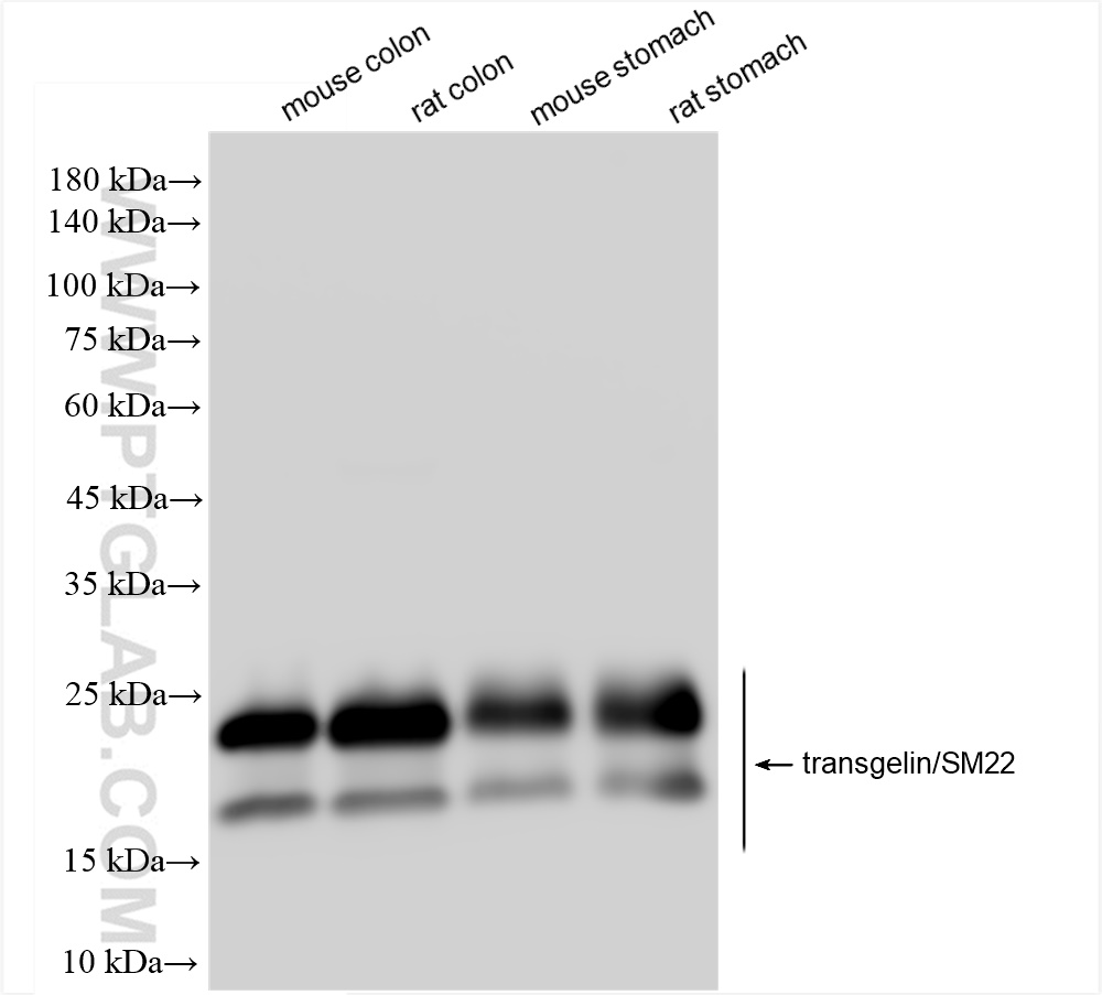 Western Blot (WB) analysis of various lysates using transgelin/SM22 Recombinant antibody (83922-2-RR)