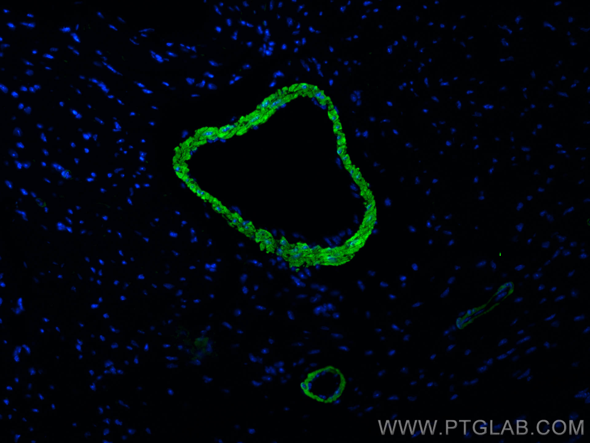 Immunofluorescence (IF) / fluorescent staining of mouse heart tissue using CoraLite® Plus 488-conjugated transgelin/SM22 Poly (CL488-10493)
