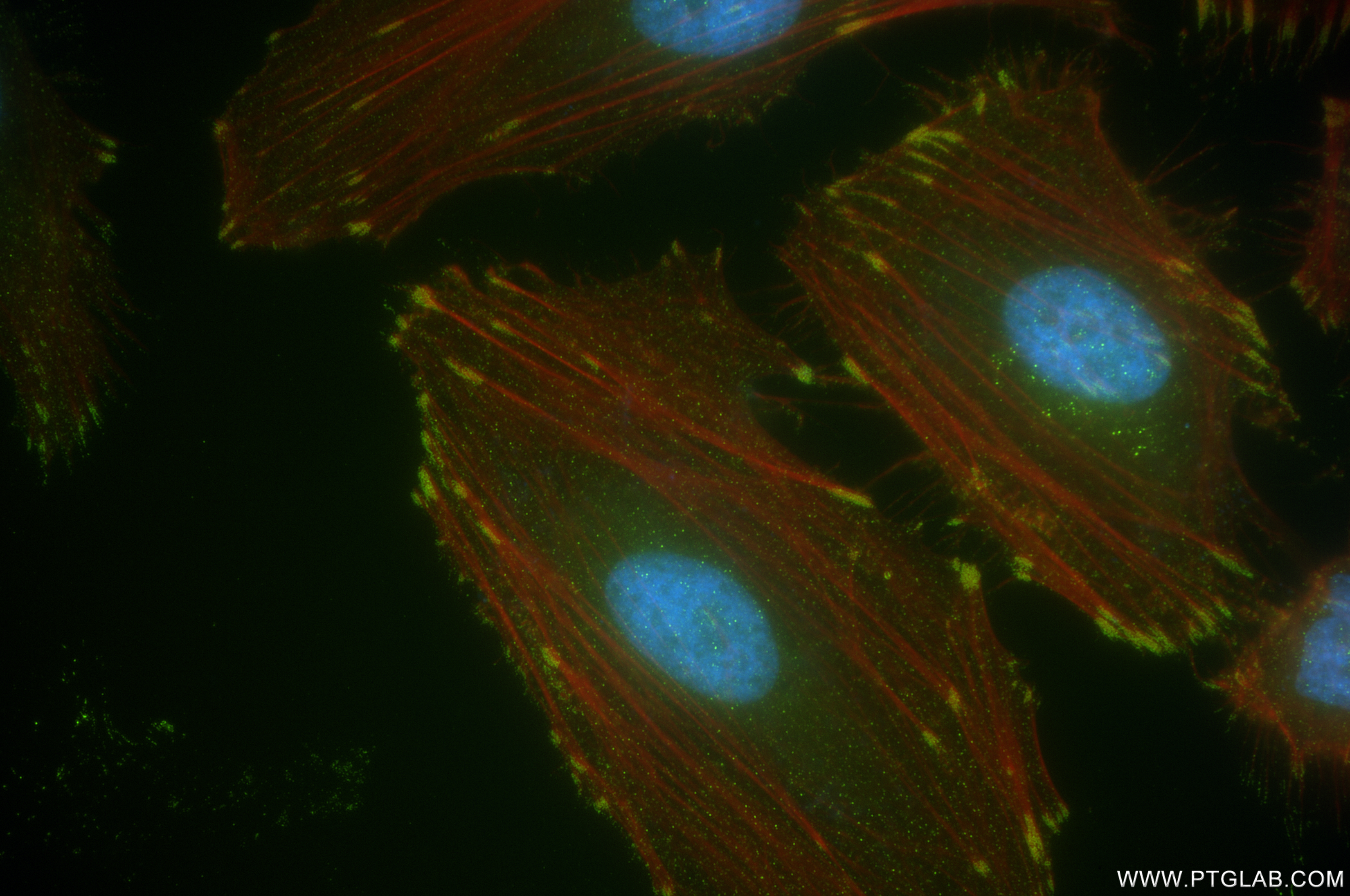 Immunofluorescence (IF) / fluorescent staining of HeLa cells using Anti-Human uPAR/CD87 Rabbit Recombinant Antibody (98048-1-RR)