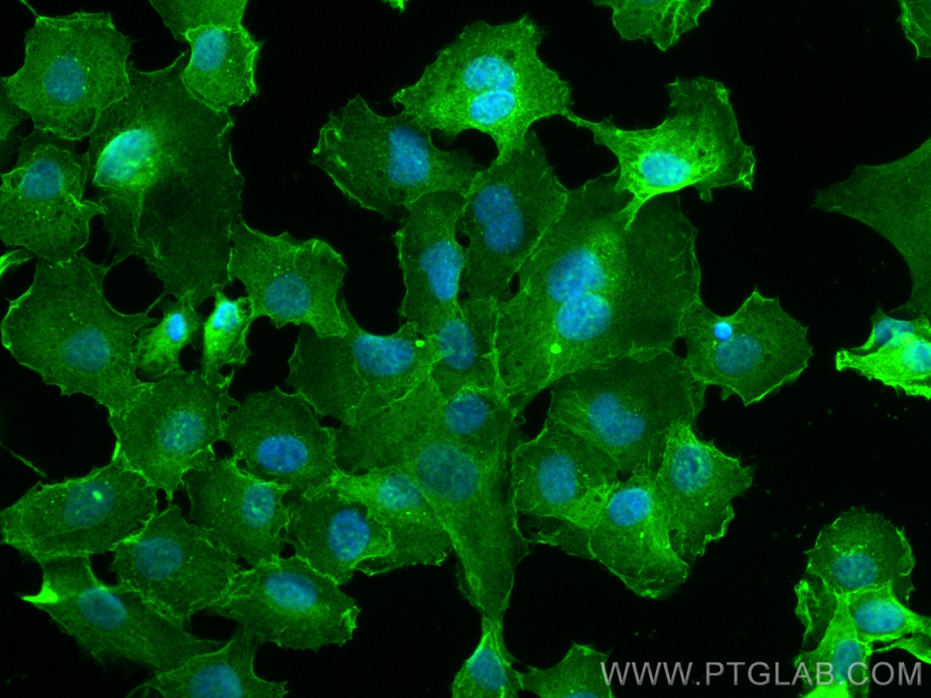 Immunofluorescence (IF) / fluorescent staining of HT-1080 cells using uPAR, PLAUR Recombinant antibody (82953-1-RR)