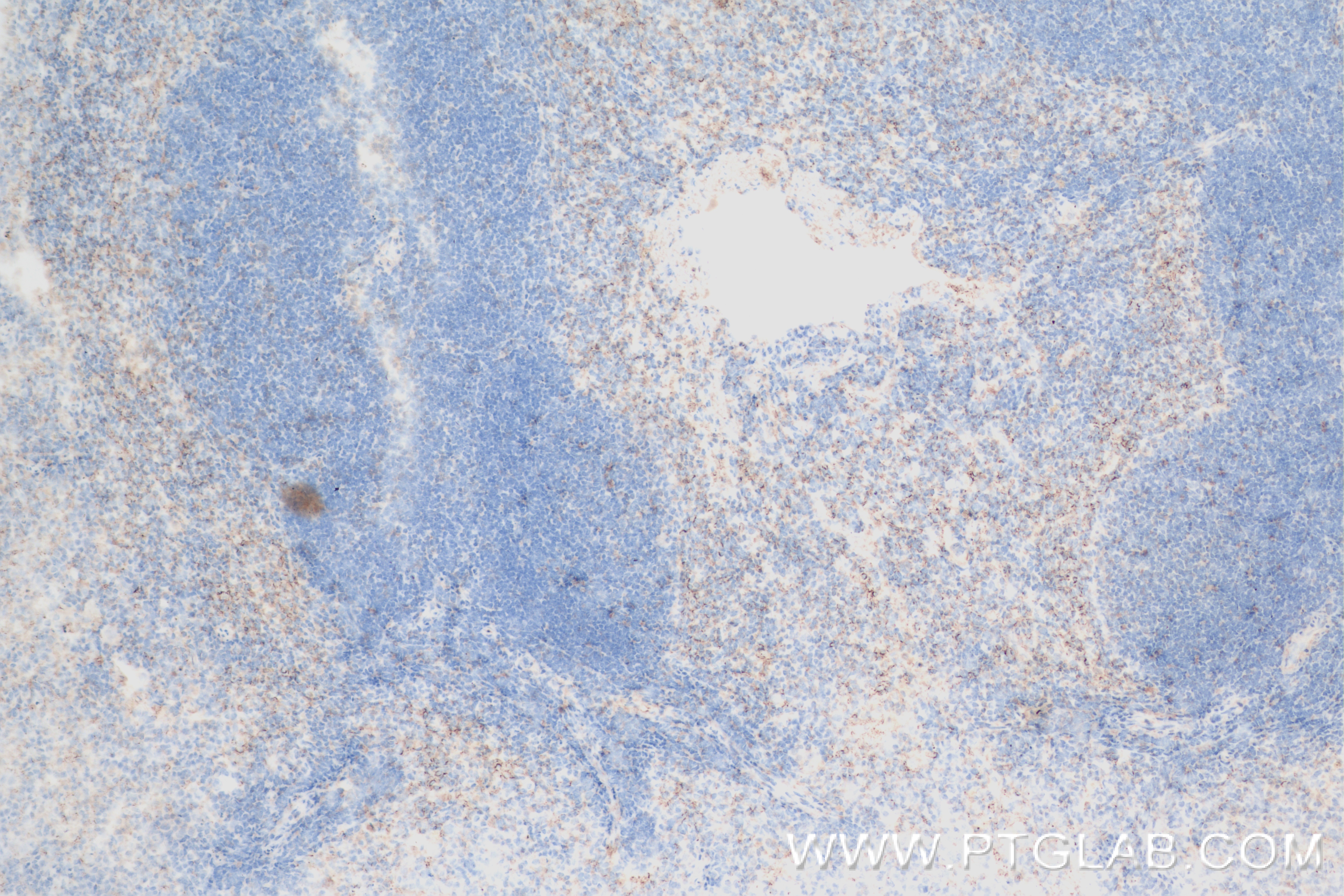 Immunohistochemistry (IHC) staining of mouse spleen tissue using uPAR/CD87 Recombinant antibody (82953-2-RR)