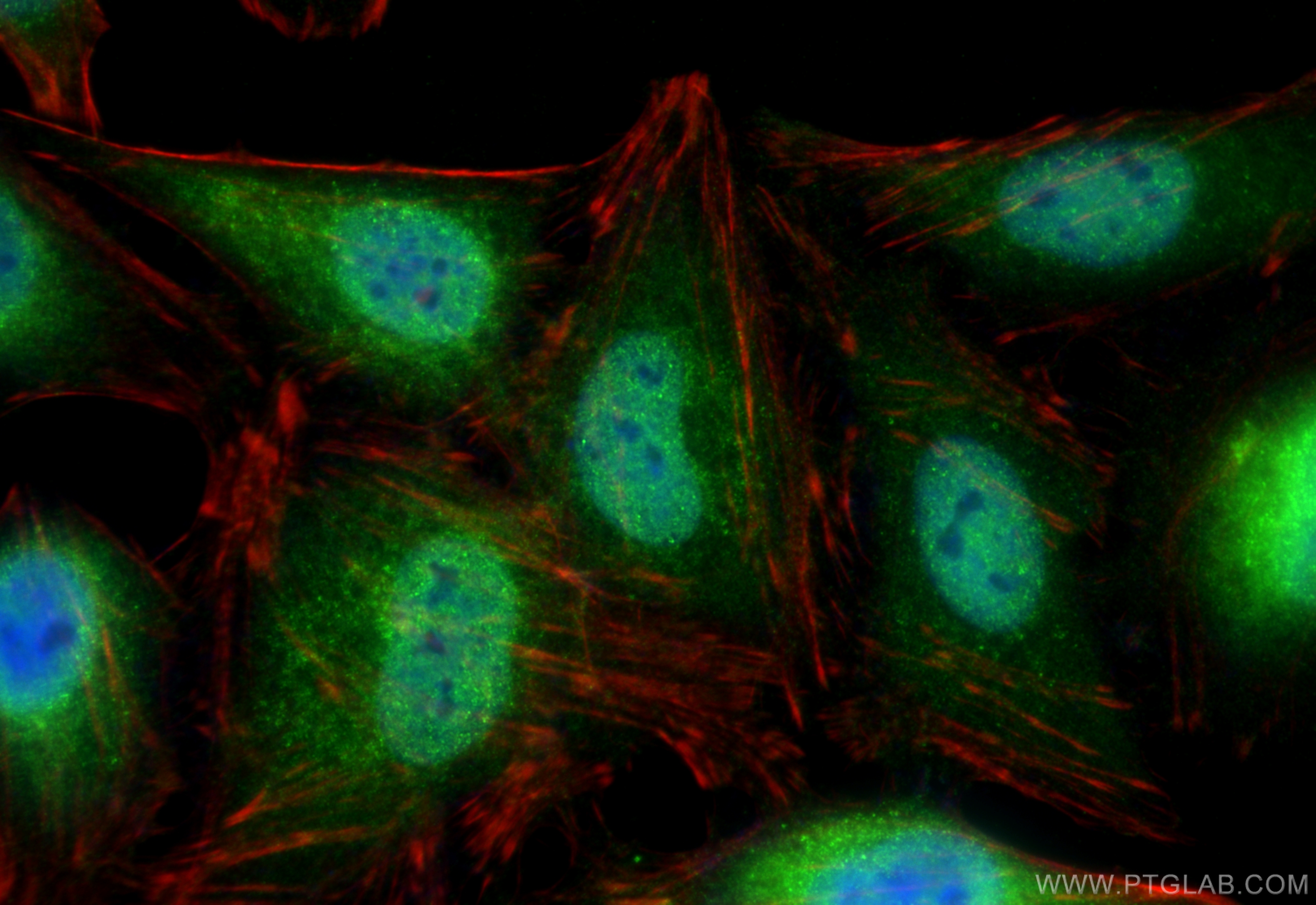 Immunofluorescence (IF) / fluorescent staining of HeLa cells using ubiquitin Recombinant antibody (80992-1-RR)