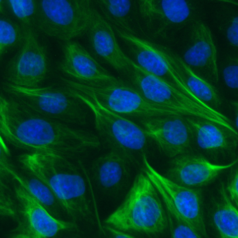 MDCK cells were immunostained with Vimentin-Booster (in green), cell nuclei were counterstained with DAPI (in blue).