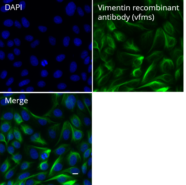 MDCK cells were immunostained with Vimentin recombinant antibody, VHH-mouse IgG1 Fc fusion [CTK0211] (vfms, 1;500) and Nano-Secondary? alpaca anti-mouse IgG1, recombinant VHH, Alexa Fluor? 647 [CTK0103, CTK0104] (sms1AF647-1, 1:500). Scale bar, 10 μM.
