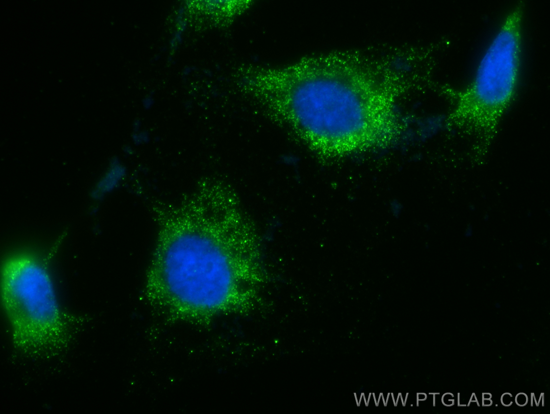 Immunofluorescence (IF) / fluorescent staining of HUVEC cells using VWF Monoclonal antibody (66682-1-Ig)