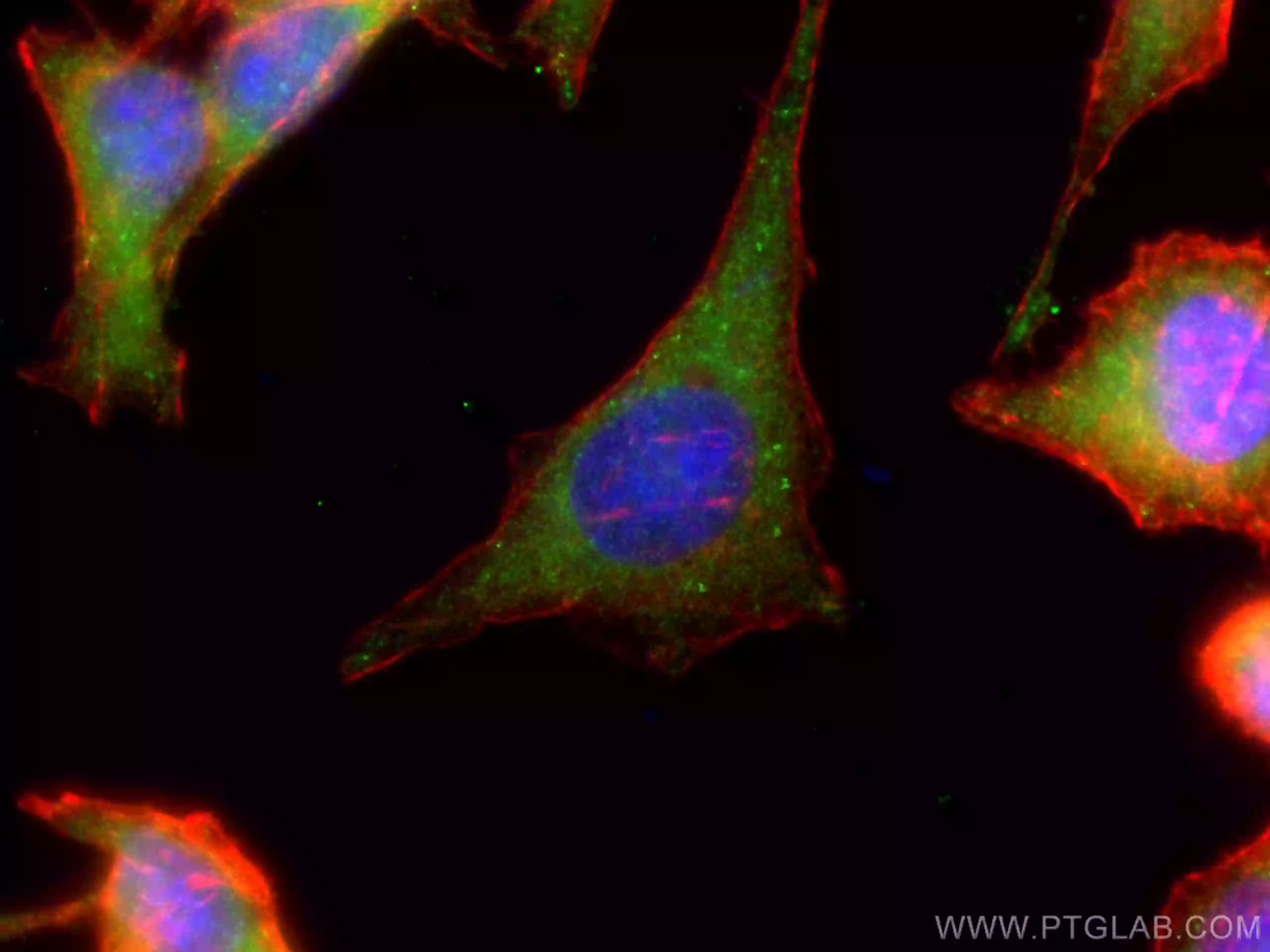 ACC1 antibody (21923-1-AP) | Proteintech