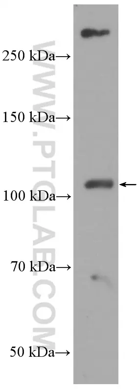 ACE2 antibody (66699-1-Ig) | Proteintech