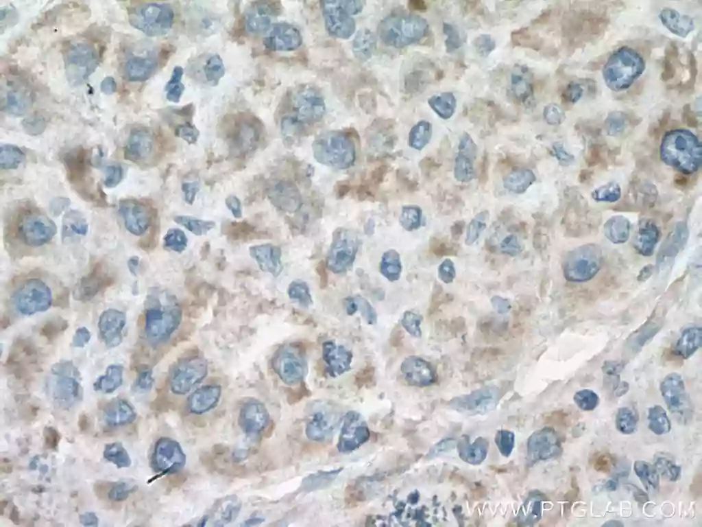 ACO2 antibody (67509-1-Ig) | Proteintech