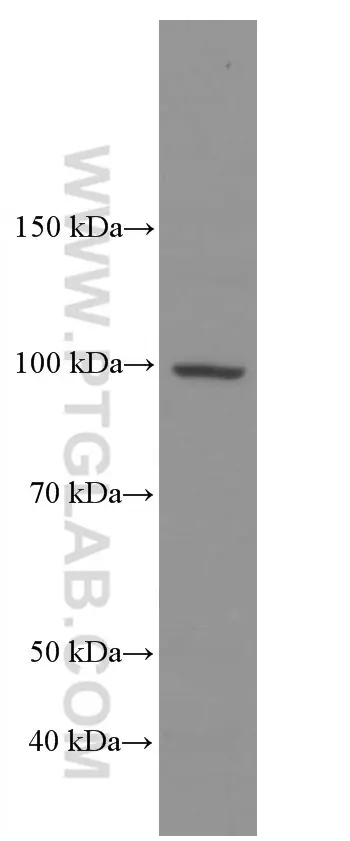 ADAM10 antibody (66620-1-Ig) | Proteintech