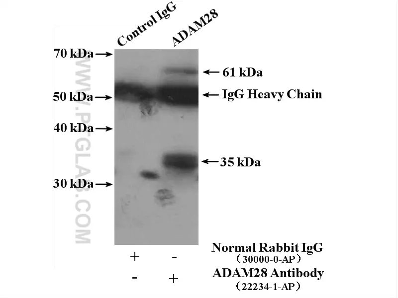 ADAM28 antibody (22234-1-AP) | Proteintech