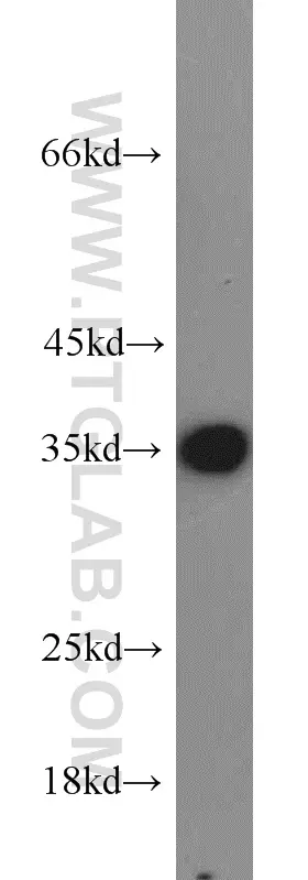 ADAM28 antibody (22234-1-AP) | Proteintech