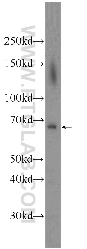 ADAM8 antibody (23778-1-AP) | Proteintech