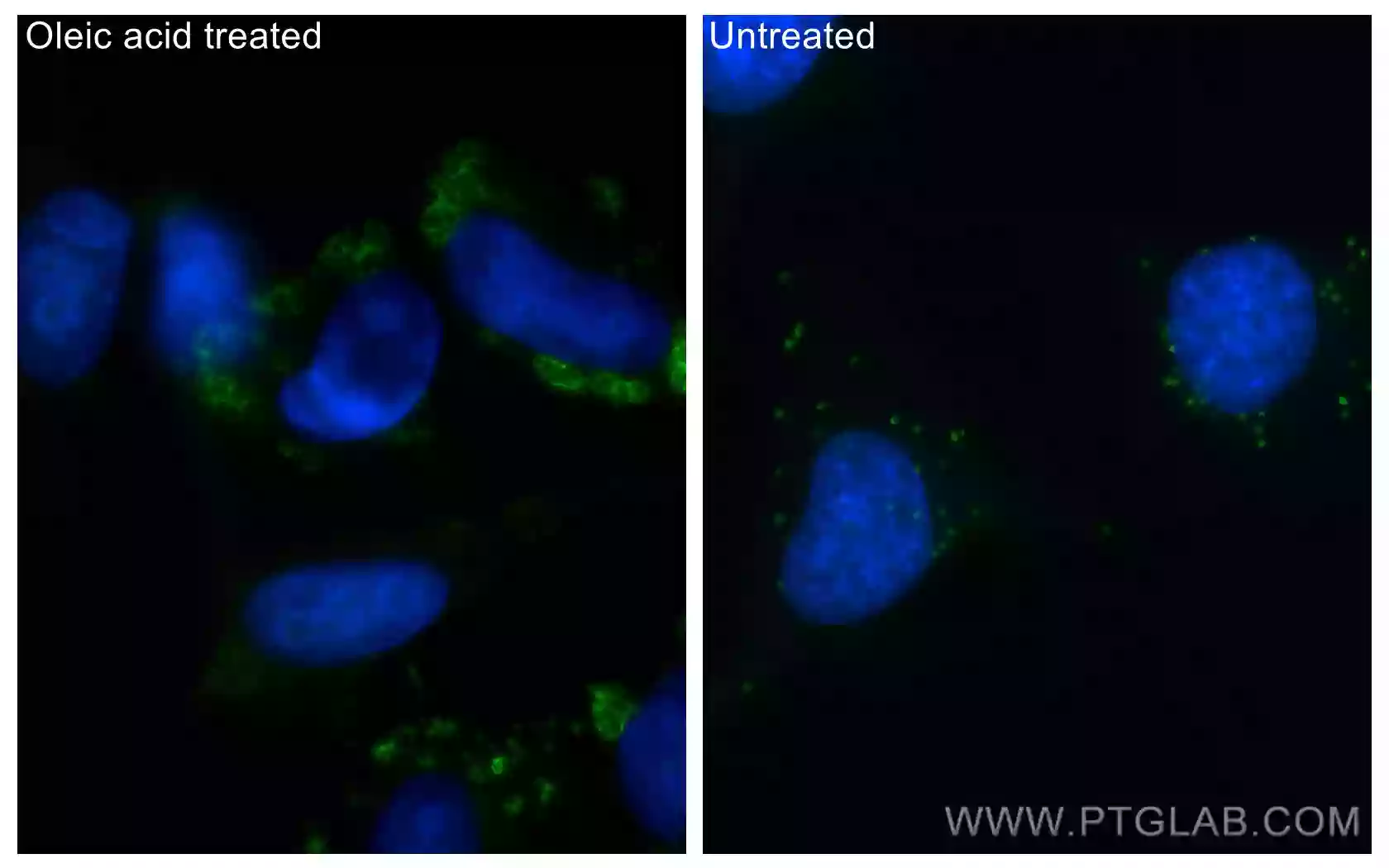 ADRP/Perilipin 2 antibody (CL488-15294) | Proteintech
