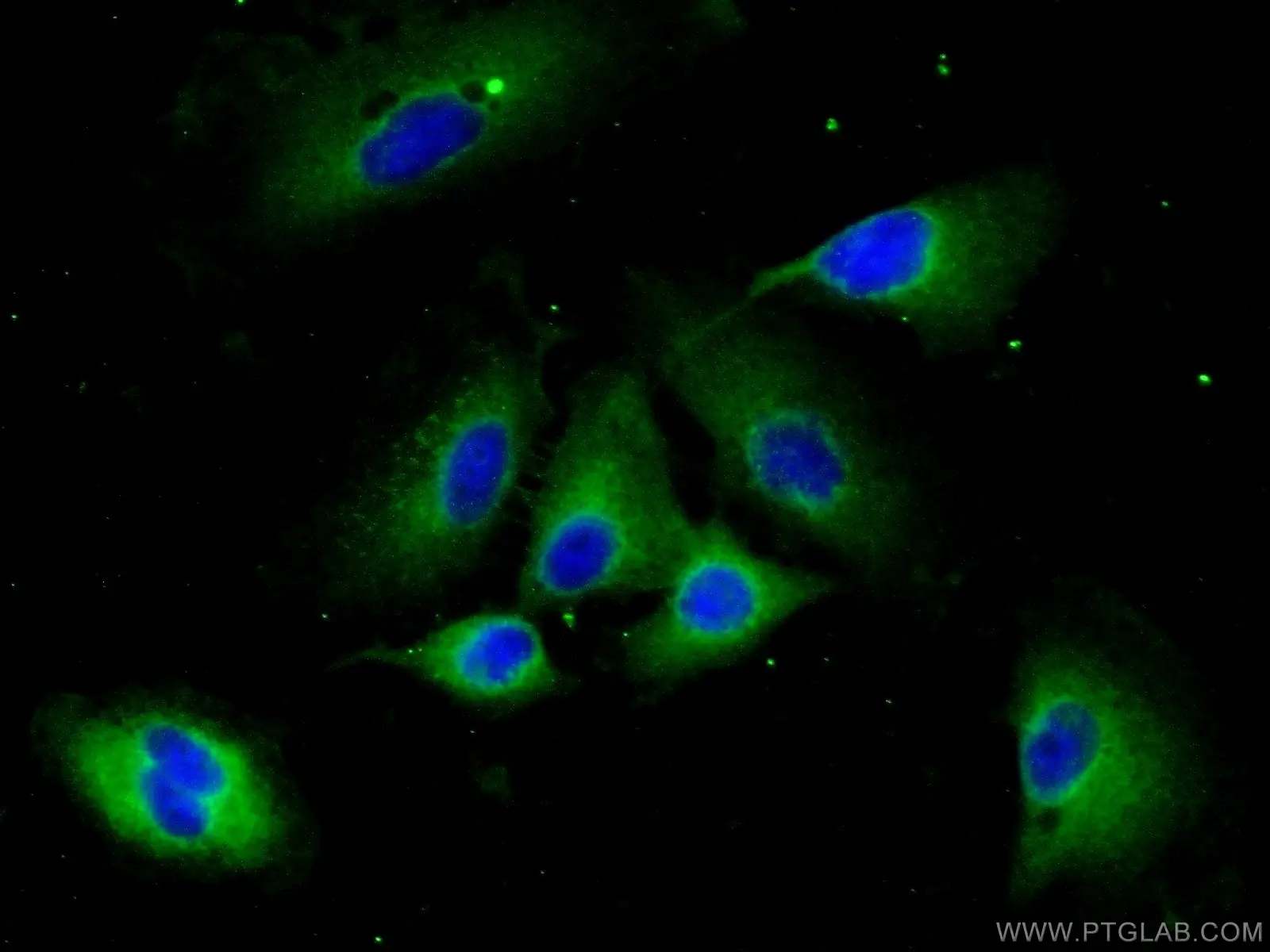 CCP1 antibody (14067-1-AP) | Proteintech