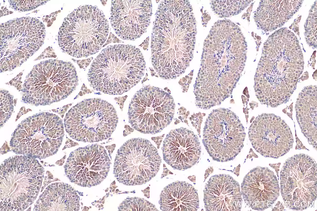 CCP1 antibody (14067-1-AP) | Proteintech